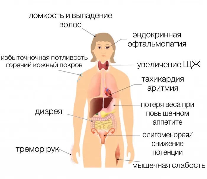 признаки нарушения